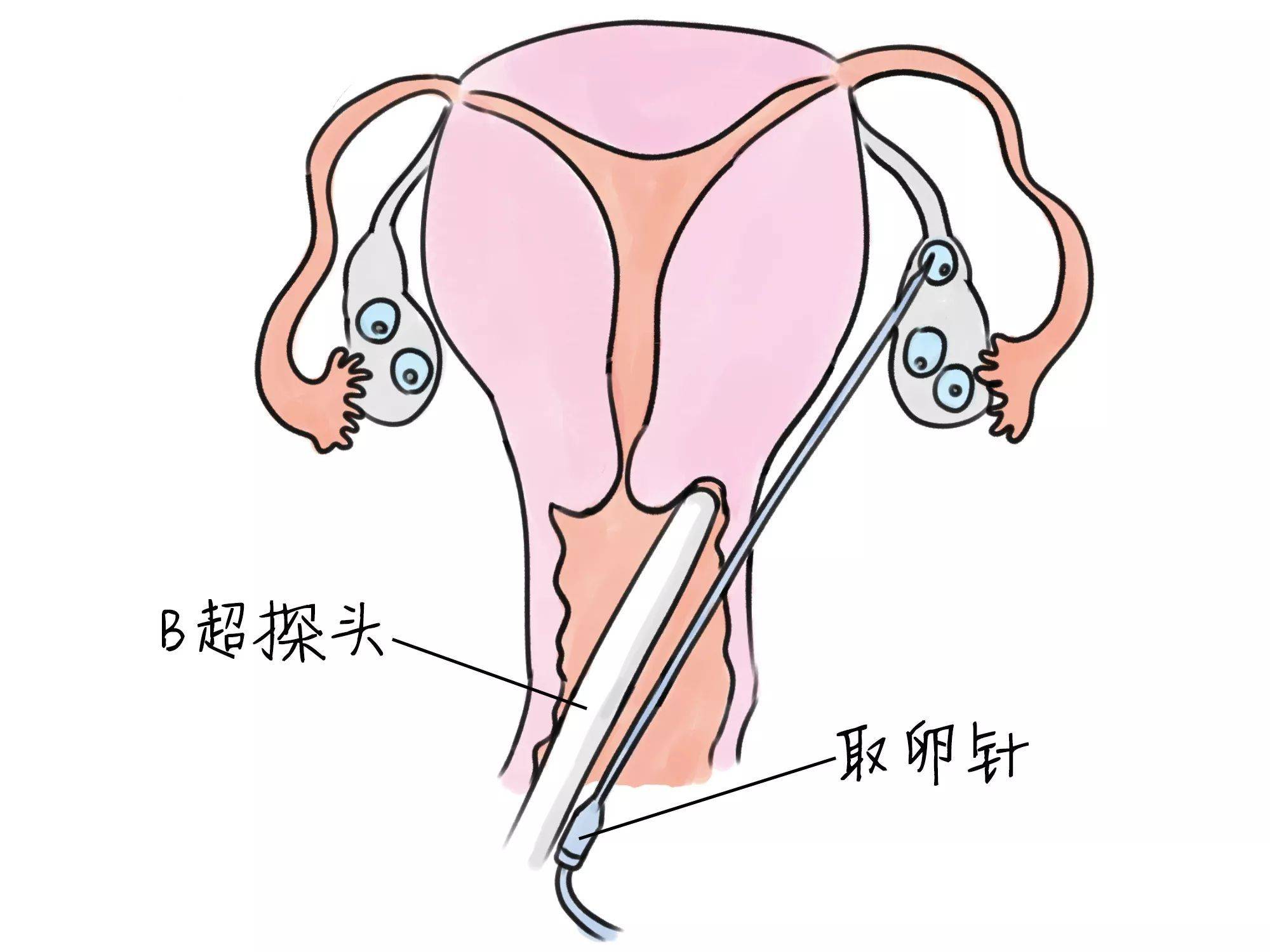 清宫半个月后小腹牵扯痛的原因及应对措施