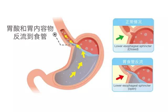 新生婴儿几个月不吐奶，成长过程中的生理变化与护理指南